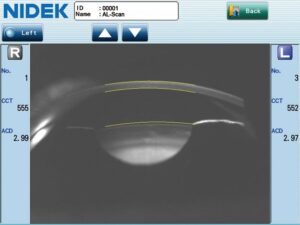 Optical Biometer AL-Scan ｜ NIDEK