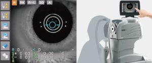 Auto Ref/Keratometer ARK-F, Auto Refractometer AR-F ｜ NIDEK